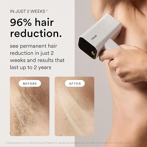 Nood™ Flasher Pro — Forbes Best Product 2026 — IPL Laser Hair Removal Device For At Home Use — Pain-Free, Permanent, Visible Results After First Use & Works Everywhere Hair Grows — Gloss White thumbnail 3