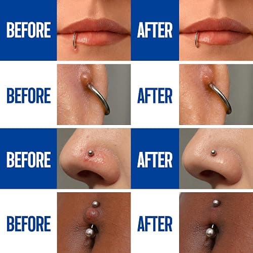 BodyJ4You Piercing Aftercare Drops - Saline Solution Natural Keloid Bump Removal - Ear Piercing Cleaner Nose Septum Belly Button Cartilage - Tea Tree Oil Sea Salt Aloe Rosemary - 0.33 Fl Oz | Cleans New Piercings Ear Nose - Soothes Septum Belly Button - Sea Salt Aloe Keloid Bump Care Travel Size 0.33 Fl Oz Dropper thumbnail 4