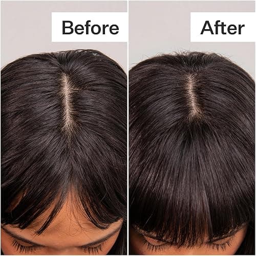 ACT+ ACRE Plant-Based Fulvic Acid Volumizing Dry Shampoo - Natural and Unscented Powder Spray Shampoo with Fulvic Acid and Rice Refresh Oily Hair and Restore Volume - Dry Shampoo for All Hair Types - 0.46 Ounce (Pack of 1) thumbnail 6