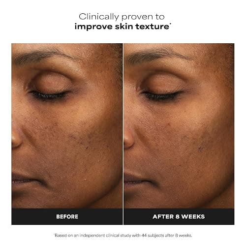Paula's Choice 6% Mandelic + 2% Lactic Acid Liquid Exfoliant | Gentle AHA Exfoliation for Discoloration, Bumpy Texture & Radiance, for Sensitive Skin, Fragrance-Free thumbnail 3