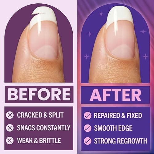 Nail Repair Kit – Fix Broken or Damaged Nails with Silk Wrap, Glue & File – Nail Repair Kit For Broken Natural Nails - Video & Written Instructions Included thumbnail 3