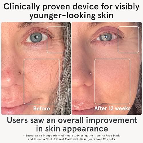 iRestore LED Face Mask for Youthful Skin, Red Light Therapy for Face, Red, Blue & Infrared Therapy for Wrinkles, Fine Lines, Dark Spots with 360 LEDs, Skincare Device for Women & Men thumbnail 2