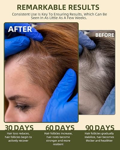 Ktintar 100% Natural Raw Batana Oil for Hair Growth, Dr Sebi Hair Growth Oil From Honduras, Thicker & Stronger Hair, Prevents Hair Loss, Eliminates Split Ends 4.23 Fl Oz (Pack of 1) thumbnail 3