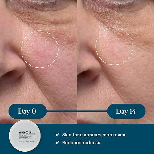 ELEMIS Dynamic Resurfacing Facial Pads, Gentle Textured Treatment Facial Exfoliating Pads thumbnail 2