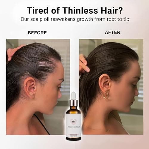 Golab Beauty Hair Oil Rosemary Scalp Treatment, Organic, Vegan, Growth And Repair For Split Ends & Dry Scalp Treatment, Strengthening, Soothing, Moisturizing & Encouraging Longer Hair 1.7 Fl Oz thumbnail 3