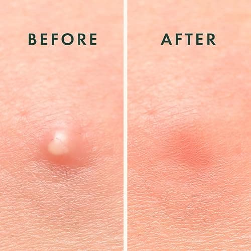 Rael Miracle Overnight Spot Cover (52 Count) thumbnail 6