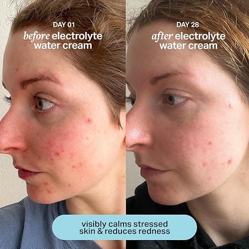Cocokind Electrolyte Water Cream, Lightweight Face Moisturizer, 1.7 Fl Oz | Facial Moisturizer & Water Cream for Oily and Combination Skin, Made with Electrolytes, Hydrating Gel Moisturizer thumbnail 4