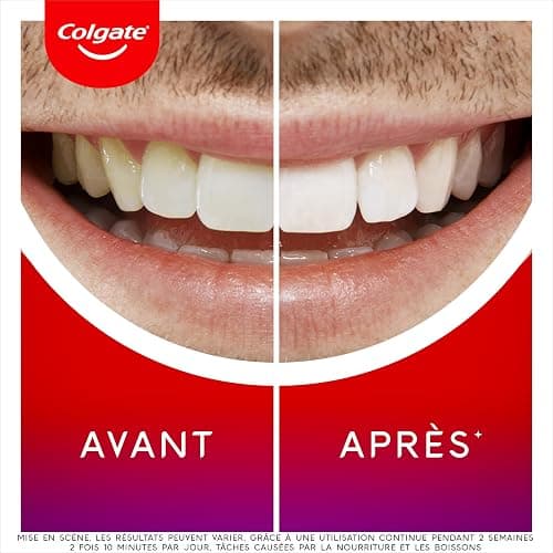 COLGATE - Kit de blanchiment dentaire - Sérum blancheur nuit et dentifrice Max White Ultra - 2,5ml + 75ml thumbnail 3