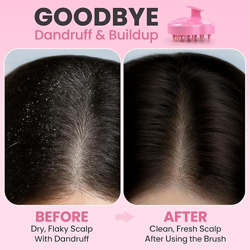 RELAXXO Scalp Massager Hair Growth – Exfoliator & Hair Scrubber for Scalp, Soft Bristles for Dandruff & Soothing Comfort, Shampoo Brush, Wet & Dry Use, Pink thumbnail 3