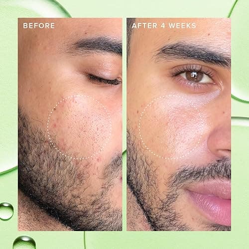 Farmacy 2% Salicylic Acid Toner for Face - Deep Sweep Gentle BHA Exfoliant for Oily Skin - Refines Texture with Papaya Enzymes & Moringa Water for a Healthy-Looking Complexion (50ml) thumbnail 5