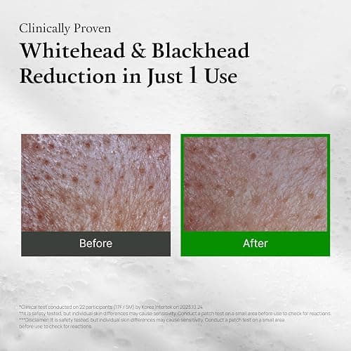 FULLY Green Tomato Clay Mask Cleanser, Cardi B’s Pore Mask Pick for 2-Minute Pore Detox, Blackhead & Sebum Control, 49% Green Tomato Extract, Vegan Fragrance-Free Korean Skincare, 4.05 fl oz thumbnail 5