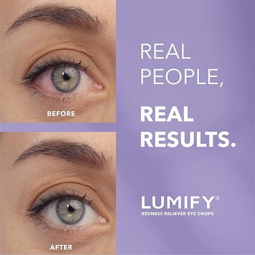 LUMIFY Eye Drops for Red Eyes, Redness Reliever for Brighter Looking Eyes, Works in 1 Minute & Lasts Up to 8 Hours, Eye Drops, 0.17 Fl Oz (5 mL) thumbnail 2