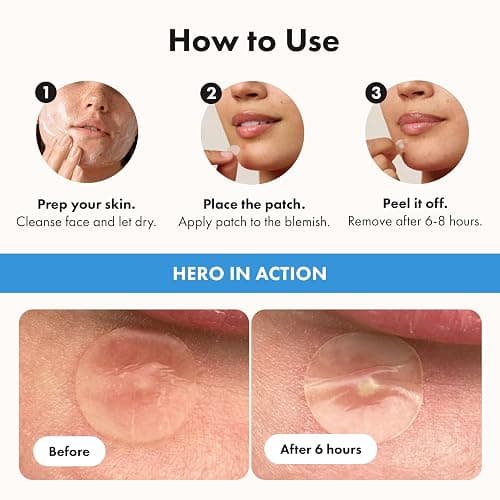 Hero Cosmetics Mighty Patch Invisible+ – Barely-there Hydrocolloid Patch for Pimples on the Face, Day-time Patches for Sensitive Skin, 39 Count thumbnail 4