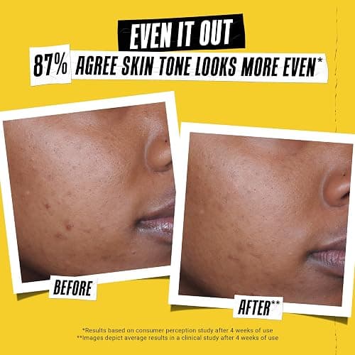 Kiehl's Better Screen UV Serum SPF 50+, Invisible Facial Sunscreen with Collagen Peptide, UV Filters to Shield UVA & UVB, Helps Correct Visible Signs of Aging, Boosts Skin Radiance thumbnail 6