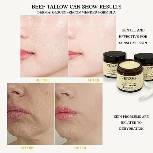 Beef Tallow for Skin and Face – Tallow and Honey Balm Moisturizer, 100% Grass-Fed Beef Tallow with Raw Organic Honey, Beeswax, Olive Oil & Vitamin E – Deep Hydration – Proudly Made in USA – 2oz thumbnail 7