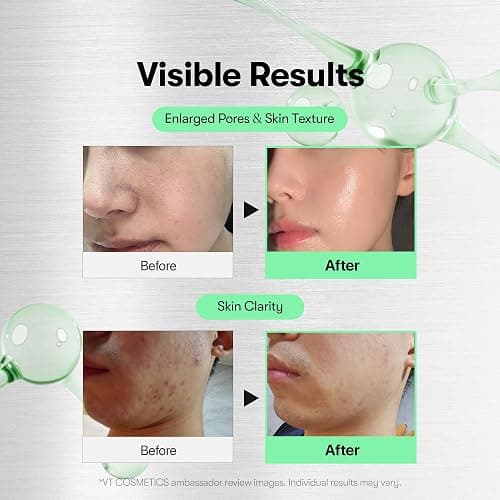 dark spot serum ! thumbnail 3