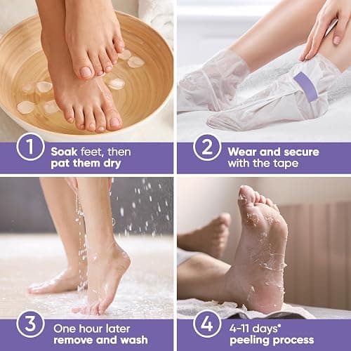 Foot Peel Mask - Foot Mask for Baby Soft Skin - Remove Dead Skin, Dry, Cracked Feet & Callus, Foot Spa, Made with Aloe Vera Extract for Women and Men (2 Pair (Pack of 1), Lavender) thumbnail 2
