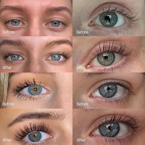 ByBabes Lash CEO Eyelash Growth Serum | Prostaglandin-Free Rapid Brow & Lash Serum For Growth, Lift & Thickness | See Fuller Looking, Healthier Eyebrows & Eyelashes In 4-6 Weeks | UK Made thumbnail 3
