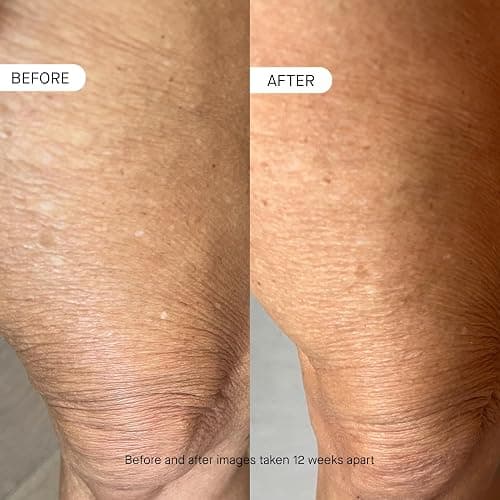 OneSkin BODY OS-01 Peptide Topical Supplement & Skin Longevity Age Reversal Moisturizer | Safe for Sensitive Skin, Fragrance-Free, 250 mL / 8.45 oz thumbnail 4