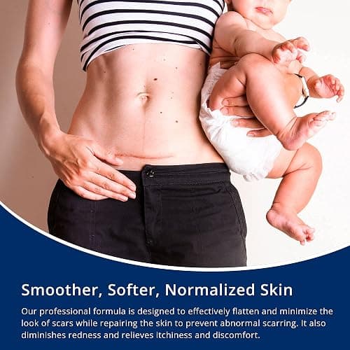 100% Silicone Scar Gel Scar Cream - Advanced Scar Gel for Surgical Scars, C-Section, Stretch Marks, Acne, Injury, Burns, Keloids, Old and New Scars 1.06oz(30g) (Maximum Strength 100% Silicone) thumbnail 5