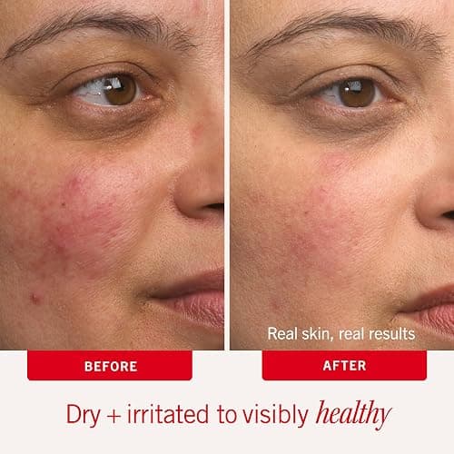 First Aid Beauty - Ultra Repair Cream thumbnail 4