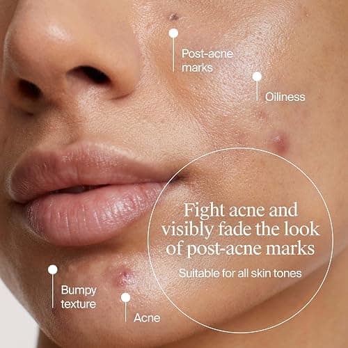Neutrogena Evenly Clear Acne Cleanser with 2% Salicylic Acid & 2% PHA Exfoliant, Gentle Foaming Face Wash Clears Clogged Pores & Blackheads While Visibly Fading Look of Post-Acne Marks, 9.1 fl. oz thumbnail 3