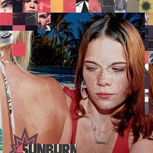 Sunburn - Image 1