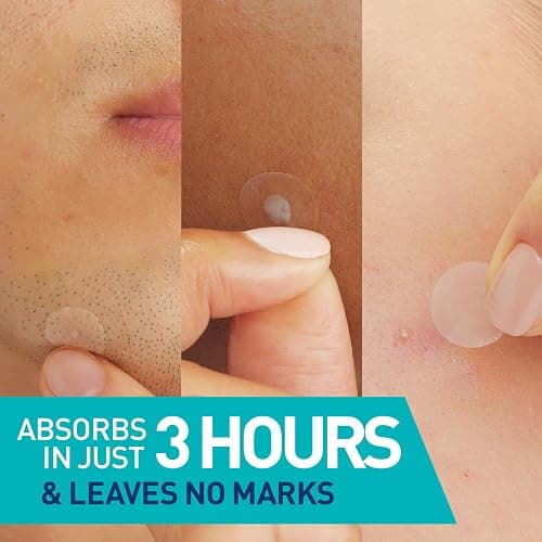 CeraVe Hydrocolloid Blemish Patches, Oil Absorbing Spot Control with Ceramides and Niacinamide, Allergy-Tested & Suitable For Sensitive Skin, Ultra-Thin & Blends Into All Skin Tones, 22ct thumbnail 2