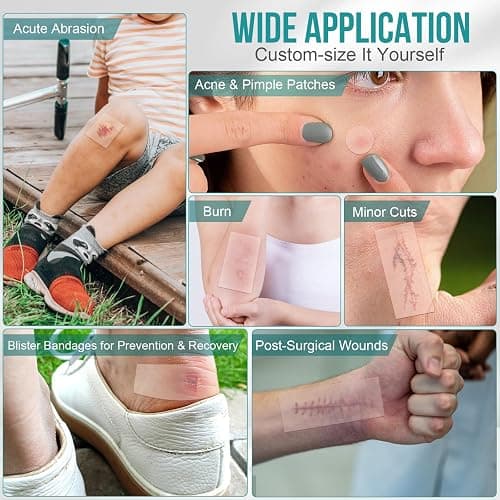Hydrocolloid Roll for Wound Care, Hydrocolloid Patch Bandages with Self-Adhesive, Bed Sore Bandages, Highly Absorbent for Burn, Blister, Acne Care, Sterile and Waterproof (2in x 12ft) thumbnail 4