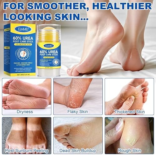 60% Urea Cream Stick plus 2% Salicylic Acid, Maximum Strength Urea Foot Cream Callus Remover for Dry Cracked Heels, Hands, Knees,Exfoliating Moisturizer, Dead Skin Remover Foot Balm 1.4oz (1pcs) thumbnail 7