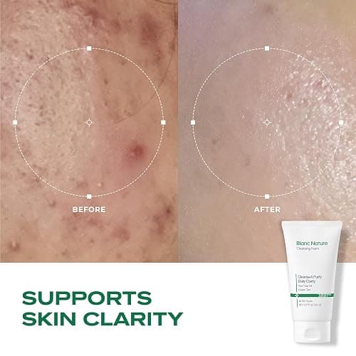 BLANC NATURE Cleansing Foam, Tea Tree Pore Deep Facial Cleanser for Oily & Sensitive Skin, Centella Asiatica, Green Tea, Korean Skincare, 5.07 fl oz (150 ml) thumbnail 4