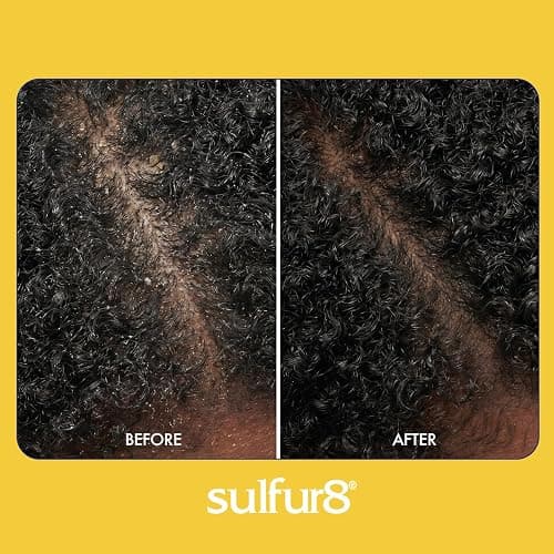 SULFUR8 Medicated Anti-Dandruff Hair & Scalp Conditioner 2 oz – Helps Control Dandruff, Soothes Itchy Scalp & Moisturizes Hair with Refreshing Clean Fragrance, For All Hair Types thumbnail 4