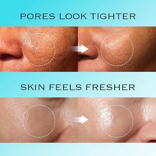 mimmua! Ice Sorbet Soothing & Cooling Face Moisturizer | Non-Comedogenic Gel Cream for Fungal Acne | Pore Minimizer for Face Under | Makeup Primer | Niacinamide & Silica for Sebum Control | 3.38 Fl Oz thumbnail 6