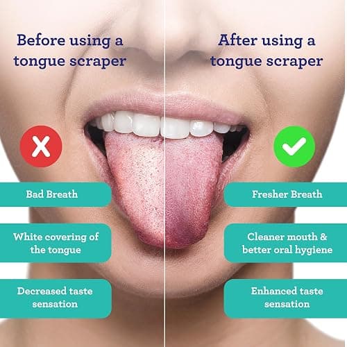 GuruNanda Tongue Scraper for Adults (2 Pack) with Travel Case, 420 Medical-grade 100% Stainless Steel Tongue Cleaner, Aids in Fresh Breath & Oral Care thumbnail 2