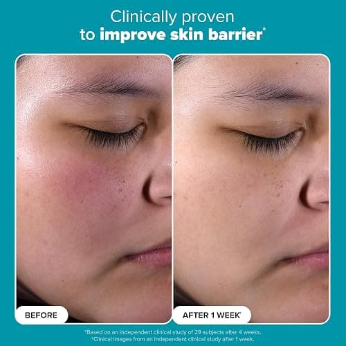 Paula's Choice SKIN PERFECTING 2% BHA Liquid Exfoliant with Salicylic Acid, Facial Polish for Enlarged Pores, Wrinkles & Fine Lines, Suitable for Blackhead-Prone Skin, Fragrance-Free thumbnail 3