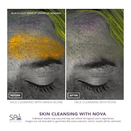 Spa Sciences - NOVA - Sonic Cleansing Brush with Bristles & Infusion System – Anti-Aging Facial Exfoliating, Waterproof, and USB Rechargeable thumbnail 7