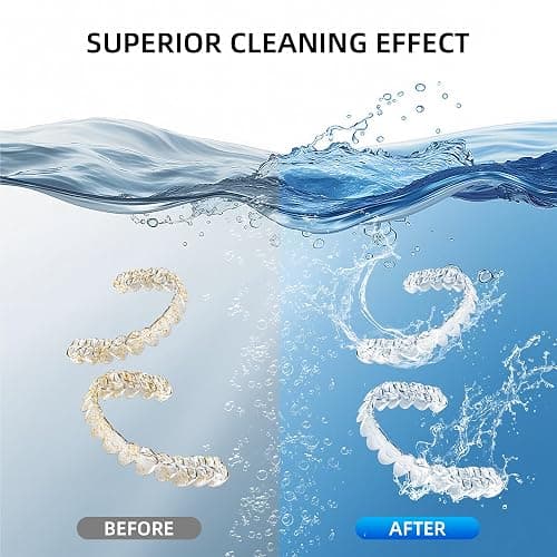 Ultrasonic Retainer Cleaner Machine, 48KHz Dental Cleaning Pod for Denture, Mouth Guard, Aligner, Night Guard, Braces, Toothbrush Heads, Jewelry with Digital Timer & 6 Modes, 13oz Capacity, White thumbnail 2