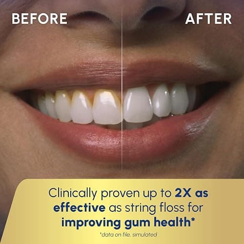 Waterpik Aquarius Water Flosser For Teeth Cleaning, Gums, Braces, Dental Care, Electric Power With 10 Settings, 7 Tips For Multiple Users And Needs, ADA Accepted, White WP-660, Packaging May Vary thumbnail 5