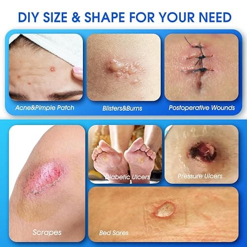 Medical Grade Hydrocolloid Roll for Wound Care, 2in*6.5ft Adhesive Hydrocolloid Bandages, Waterproof Pimple Patch Roll, Ultra Absorbent Large Hydrocolloid Patch for Acne, Blisters,Burns,and Minor Cuts thumbnail 3