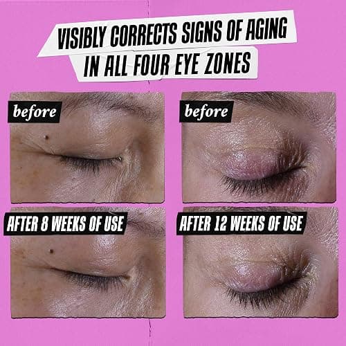 Kiehl's Super Multi-Corrective Eye Cream, Anti-Aging Cream that Lifts Brow Bone Area, Smooths and Firms Eye Lids, Bilberry Seed Extract and Collagen Peptide for Tighter and Smoother Looking Skin thumbnail 3