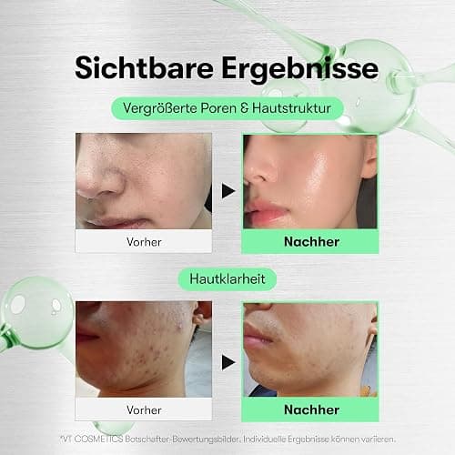 VT COSMETICS CICA Reedle Shot 50 Mikronadel-Serum,1,69 fl. oz. (50ml) | Spicule Mikronadel-Serum für Porenpflege & Peeling, Exosom, Centella Asiatica für glasige Haut, geschmeidige Textur thumbnail 4