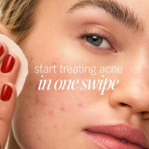 First Aid Beauty Acne Pads for Face - Maximum Strength Acne Treatment - 2% Salicylic Acid Pads Treat Without Drying, (60-ct) thumbnail 2