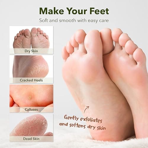 Purederm Shiny & Soft Foot Peeling Mask (3 pack) - For smooth and moist baby skin with Exfoliating peel off Calluses, Dry Skin, Cracked Heels - Men and Women thumbnail 8