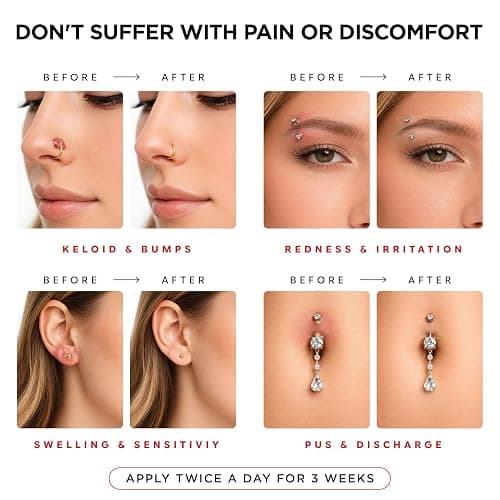 Piercing Aftercare Spray | Ear Piercing Cleaner | Sterile Saline Spray 8oz | Saline Solution for Piercings; Aftercare of Pierced Ear, Septum, Belly, Nose, Body; Pierce Cleaner Salt Mist Bump Solution thumbnail 3