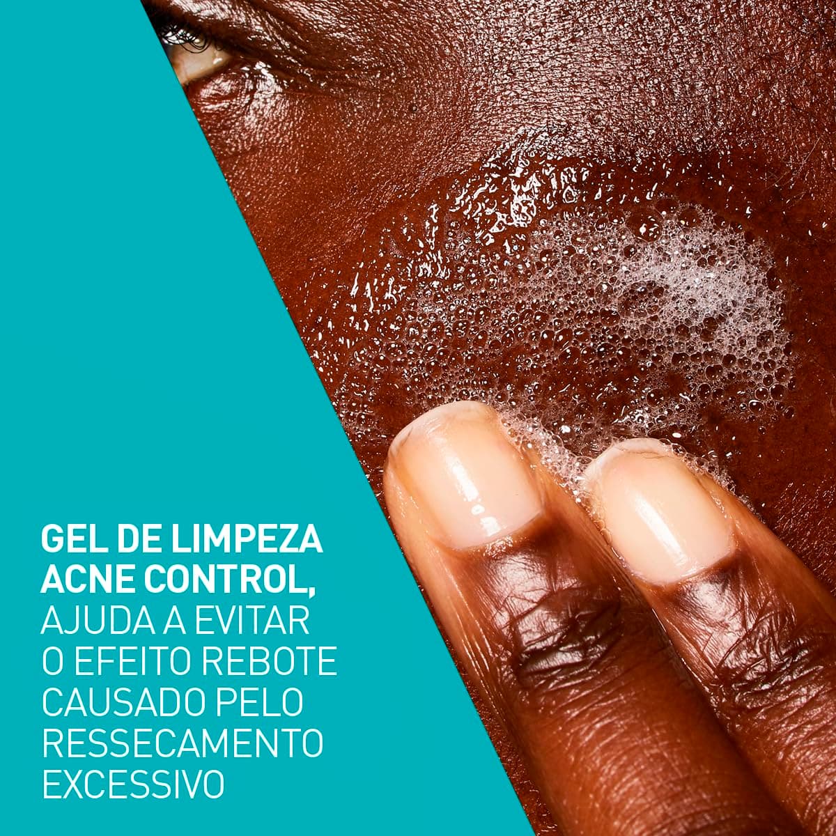 Cerave, Gel de Limpeza Acne Control com Niacinamida e Ácido Salicílico thumbnail 9