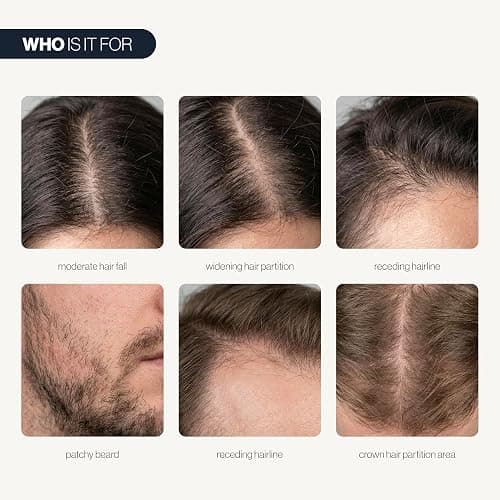Be Bodywise Hair Growth Serum Roll On - 5% Saw Palmetto, 3% Rosemary Oil for Hair Growth, 3% Fenugreek,1% Caffeine Herbasome | Serum for Hair Loss & Hair Regrowth For Men & Women 25ml/0.84 fl oz thumbnail 3
