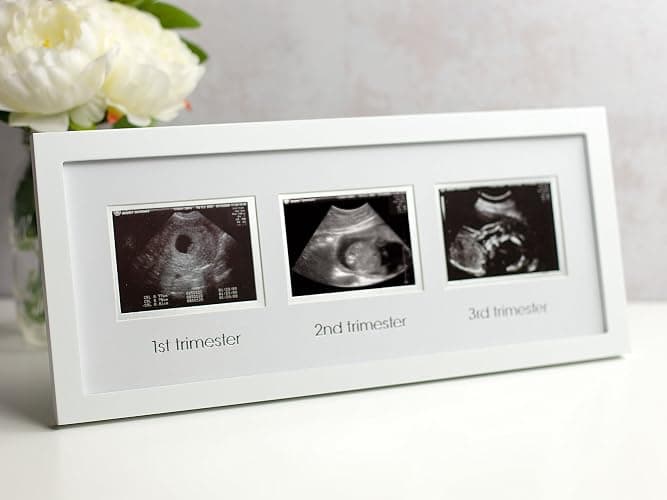Pearhead Sonogram Progression Frame - Trimester Pregnancy Milestone Keepsake, Gender-Neutral Nursery Decor, Displays 1st, 2nd & 3rd Trimesters Ultrasound Photos, White thumbnail 2