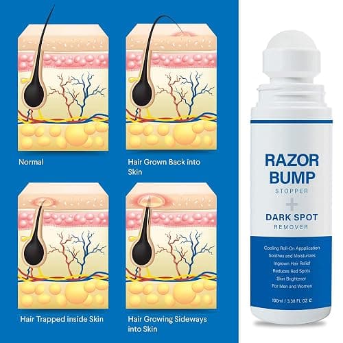 Razor Bump Stopper with Ingrown Hair Treatment: Razor Bumps Treatment for Men and Women, After Shave Solution for Ingrown Hairs and Razor Burns, Roll on Applicator - 3.38 Fl Oz thumbnail 3
