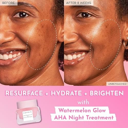 Glow Recipe Watermelon Glow AHA Night Treatment - Overnight Resurfacing Mask with AHA Complex, Hyaluronic Acid, Niacinamide & Watermelon Enzymes for Smooth, Glowing, Even-Toned Skin (60ml) thumbnail 5