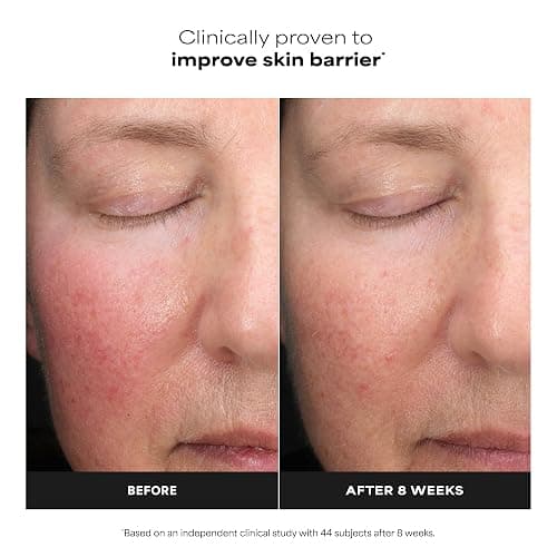 Paula's Choice 6% Mandelic + 2% Lactic Acid Liquid Exfoliant | Gentle AHA Exfoliation for Discoloration, Bumpy Texture & Radiance, for Sensitive Skin, Fragrance-Free thumbnail 4